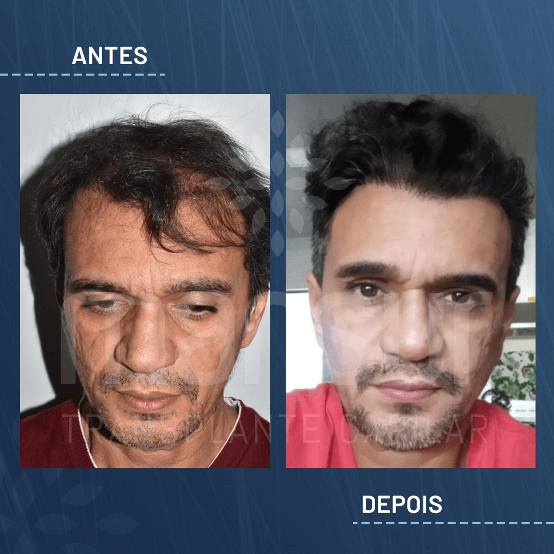 Antes e Depois_site_aprovado_Urbano
