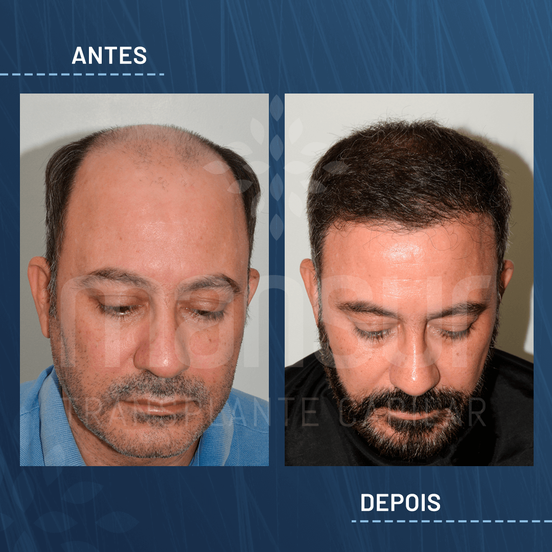 Claudio Adriano Martins